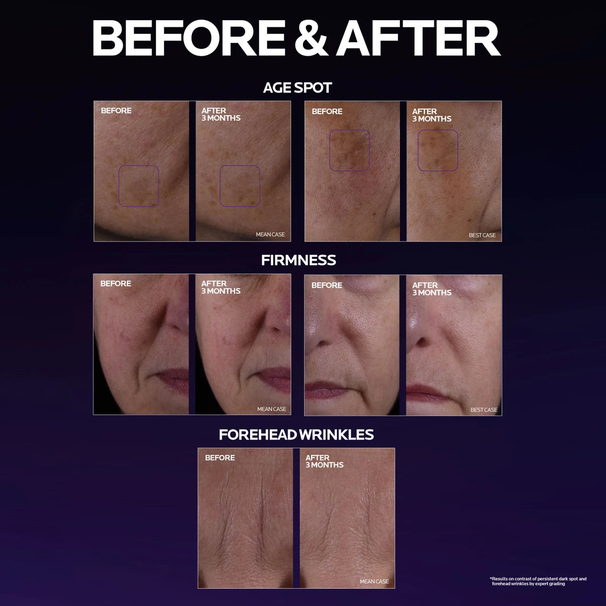 Mela B3 Double Dose Discoloration Treatment with Melasyl™